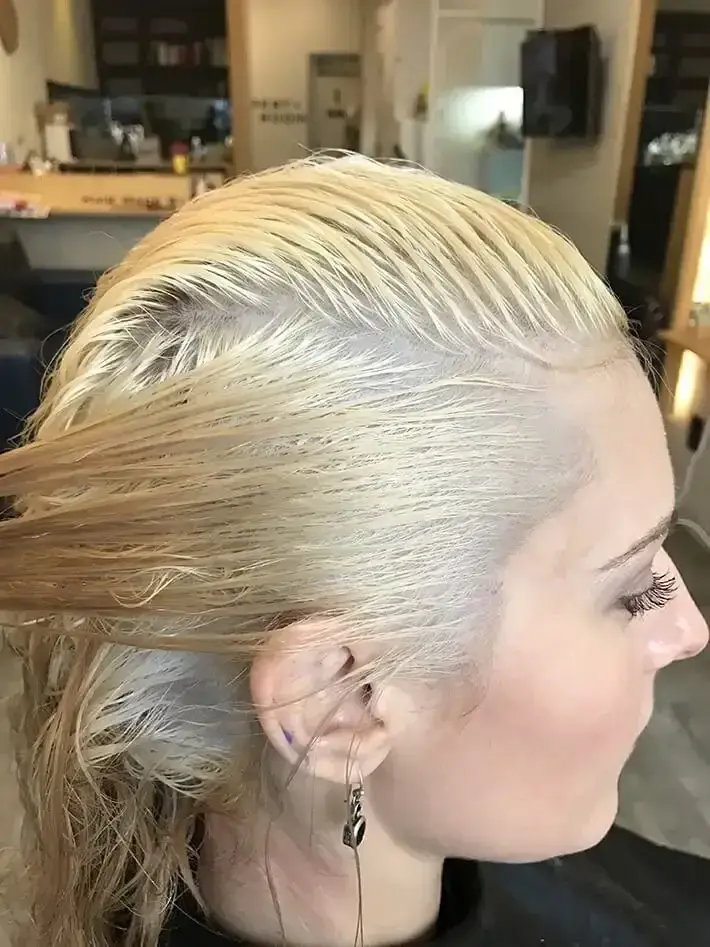 Your 20 most frequently asked questions about bleaching - answered ...