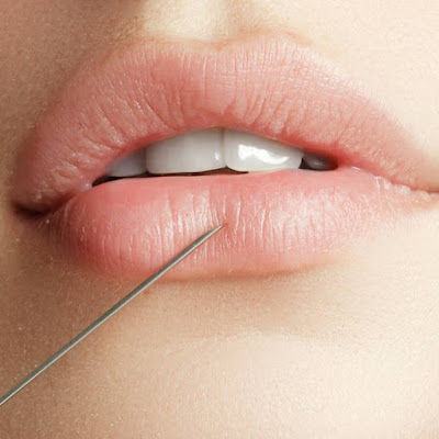 Understanding the Anatomy of Lips Understanding the Anatomy of Lips