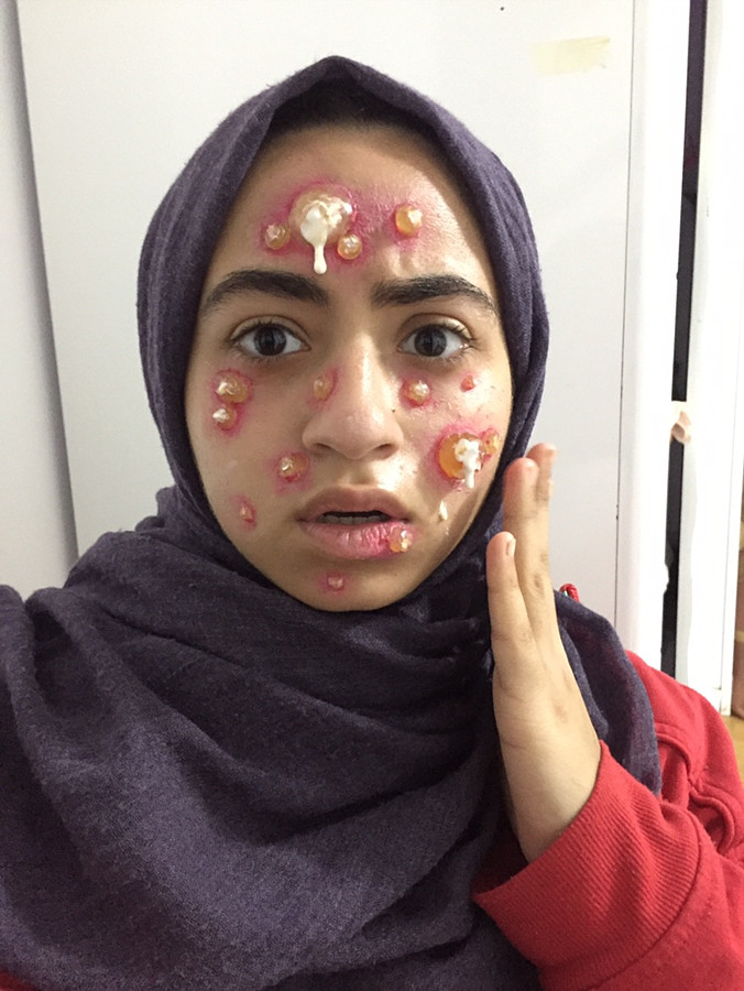 Special Fx Makeup Horror Film SFX Photo 207900 by Manar Mohamed